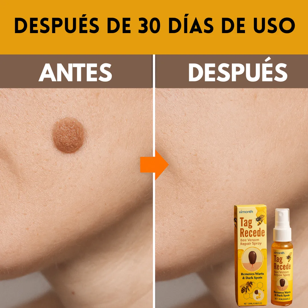 DermaClear - Spray para eliminar verrugas